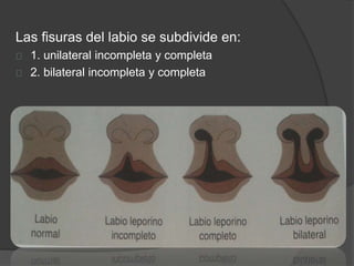 patologia: alteraciones de hueso | PPTX