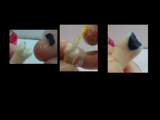 Presentación patrón de cera