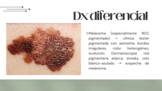 1.Melanoma (especialmente BCC
pigmentado) — clínica: lesión
pigmentada con asimetría, bordes
irregulares, color heterogéneo,
evolución. Dermatoscopía: red
pigmentaria atípica, streaks, velo
blanco-azulado → sospecha de
melanoma.
Dxdiferencial
 