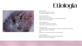 Etiologia
🔹Edad avanzada
• 50–60 años (mayoría en >65 años).
• Acumulación de daño actínico (UV).
🔹Exposición solar (UV)
• Crónica (trabajo al aire libre).
• Intermitente e intensa (quemaduras en infancia/adolescencia).
• Artificial: cabinas de bronceado.
🔹Radioterapia previa
• Zonas irradiadas (cabeza, cuello, tórax).
• Latencia de 10–20 años tras la exposición.
🔹Inmunosupresión
• Trasplante de órgano sólido (ciclosporina, tacrolimus, azatioprina, micofenolato).
• Corticoides sistémicos prolongados.
• VIH.
• Biológicos e inmunosupresores (anti-TNF, metotrexato).
🔹Factores genéticos
• Síndrome de Gorlin-Goltz (nevoid basal cell carcinoma).
• Mutaciones en PTCH1, vía Hedgehog.
 