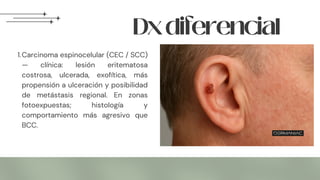 1.Carcinoma espinocelular (CEC / SCC)
— clínica: lesión eritematosa
costrosa, ulcerada, exofítica, más
propensión a ulceración y posibilidad
de metástasis regional. En zonas
fotoexpuestas; histología y
comportamiento más agresivo que
BCC.
Dxdiferencial
 