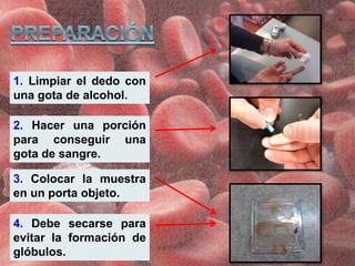1. Limpiar el dedo con
una gota de alcohol.
2. Hacer una porción
para conseguir una
gota de sangre.
3. Colocar la muestra
en un porta objeto.
4. Debe secarse para
evitar la formación de
glóbulos.
 