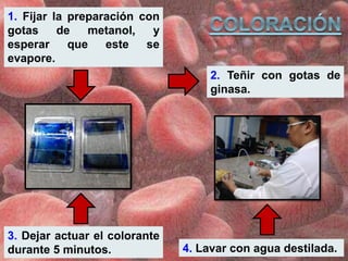 1. Fijar la preparación con
gotas de metanol, y
esperar que este se
evapore.
2. Teñir con gotas de
ginasa.
3. Dejar actuar el colorante
durante 5 minutos. 4. Lavar con agua destilada.
 
