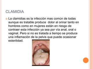 CLAMIDIA
   La clamidias es la infección mas común de todas
    aunque es tratable produce dolor al orinar tanto en
    hombres como en mujeres están en riesgo de
    contraer esta infección ya sea por vía anal, oral o
    vaginal. Pero si no es tratada a tiempo se produce
    una inflamación de la pelvis que puede ocasionar
    esterilidad.
 