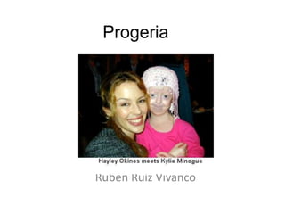 Progeria




Ruben Ruíz Vivanco
 
