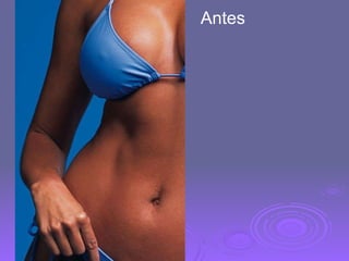 Antes 