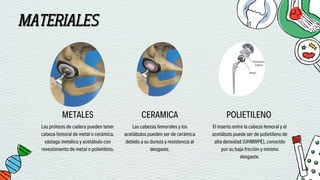 MATERIALES
MATERIALES
METALES
Las prótesis de cadera pueden tener
cabeza femoral de metal o cerámica,
vástago metálico y acetábulo con
revestimiento de metal o polietileno.
CERAMICA
Las cabezas femorales y los
acetábulos pueden ser de cerámica
debido a su dureza y resistencia al
desgaste.
POLIETILENO
El inserto entre la cabeza femoral y el
acetábulo puede ser de polietileno de
alta densidad (UHMWPE), conocido
por su baja fricción y mínimo
desgaste.
 