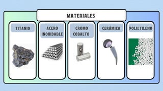 TITANIO ACERO
INOXIDABLE
CROMO
COBALTO
CERÁMICA POLIETILENO
MATERIALES
 