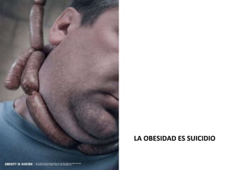 LA OBESIDAD ES SUICIDIO 