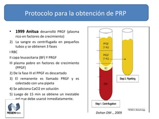 <ul><li>1999 Anitua  desarrolló PRGF (plasma rico en factores de crecimiento) </li></ul><ul><li>La sangre es centrifugada ...