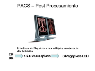 Estaciones de Diagnóstico con múltiples monitores de  alta definición PACS – Post Procesamiento CR DR 3 Megapixels LCD 1500 x 2000 pixels 