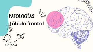 PATOLOGÍAS
Lóbulo frontal
Grupo 4
 
