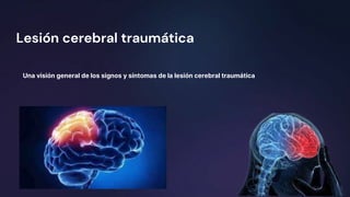 Lesión cerebral traumática
Una visión general de los signos y síntomas de la lesión cerebral traumática
 