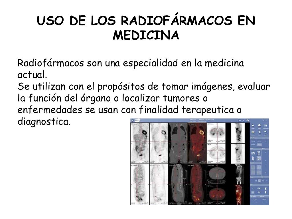Aplicaciones de la radioactividad