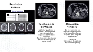 principios fisicos del tomografo.pdf