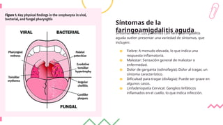 Síntomas de la
faringoamigdalitis aguda
Síntomas clave: Los pacientes con faringoamigdalitis
aguda suelen presentar una variedad de síntomas, que
incluyen:
● Fiebre: A menudo elevada, lo que indica una
respuesta inflamatoria.
● Malestar: Sensación general de malestar o
enfermedad.
● Dolor de garganta (odinofagia): Dolor al tragar, un
síntoma característico.
● Dificultad para tragar (disfagia): Puede ser grave en
algunos casos.
● Linfadenopatía Cervical: Ganglios linfáticos
inflamados en el cuello, lo que indica infección.
 