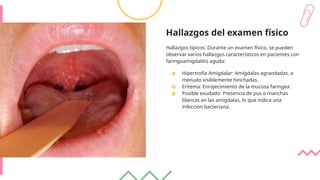 Hallazgos del examen físico
Hallazgos típicos: Durante un examen físico, se pueden
observar varios hallazgos característicos en pacientes con
faringoamigdalitis aguda:
● Hipertrofia Amigdalar: Amígdalas agrandadas, a
menudo visiblemente hinchadas.
● Eritema: Enrojecimiento de la mucosa faríngea.
● Posible exudado: Presencia de pus o manchas
blancas en las amígdalas, lo que indica una
infección bacteriana.
 