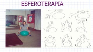 ESFEROTERAPIA
 