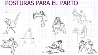 POSTURAS PARA EL PARTO
 