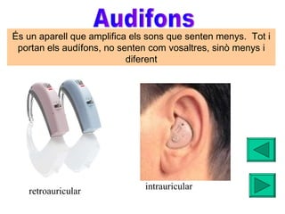 Audifons retroauricular intrauricular És un aparell que amplifica els sons que senten menys.  Tot i portan els audífons, no senten com vosaltres, sinò menys i diferent 