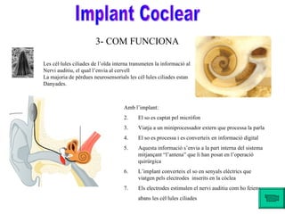 3- COM FUNCIONA Implant Coclear Les cèl·lules ciliades de l’oïda interna transmeten la informació al  Nervi auditiu, el qual l’envia al cervell La majoria de pèrdues neurosensorials les cèl·lules ciliades estan  Danyades. Amb l’implant: El so es captat pel micròfon Viatja a un miniprocessador extern que processa la parla El so es processa i es converteix en informació digital Aquesta informació s’envia a la part interna del sistema mitjançant “l’antena” que li han posat en l’operació quirúrgica L’implant converteix el so en senyals elèctrics que viatgen pels electrodes  inserits en la còclea Els electrodes estimulen el nervi auditiu com ho feien  abans les cèl·lules ciliades 
