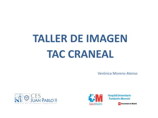 TALLER DE IMAGEN
TAC CRANEAL
Verónica Moreno Alonso
 