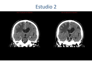 Estudio 2
 