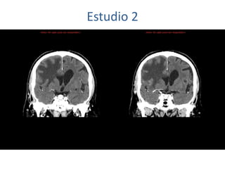 Estudio 2
 