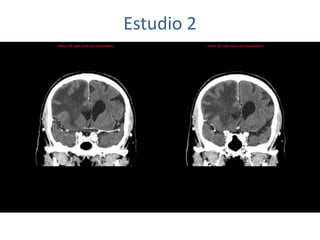 Estudio 2
 