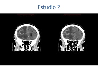 Estudio 2
 