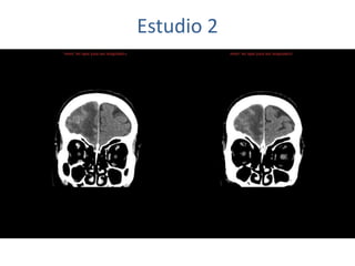 Estudio 2
 