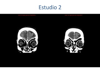 Estudio 2
 