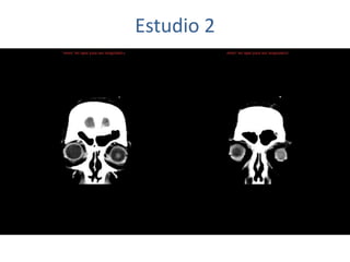 Estudio 2
 