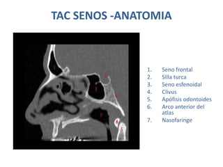 TAC SENOS -ANATOMIA
1. Seno frontal
2. Silla turca
3. Seno esfenoidal
4. Clivus
5. Apófisis odontoides
6. Arco anterior del
atlas
7. Nasofaringe
 