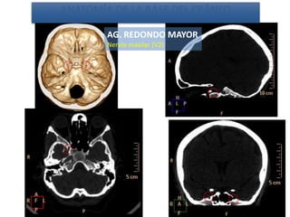 AG. REDONDO MAYOR
Nervio maxilar (V2)
ANATOMÍA DE LA BASE DEL CRÁNEO
 