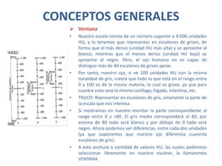 CONCEPTOS GENERALES
 Ventana
• Nuestra escala consta de un número superior a 4.000 unidades
HU, y lo tenemos que representar en escalones de grises, de
forma que el más denso (unidad HU más alta) y se aproxime al
blanco, mientras que el menos denso (unidad HU baja) se
aproxime al negro. Pero, el ojo humano no es capaz de
distinguir más de 40 escalones de grises aprox.
• Por tanto, nuestro ojo, si ve 100 unidades HU con la misma
tonalidad de gris, creerá que todo lo que está en el rango entre
0 y 100 es de la misma materia, lo cual es grave; ya que para
nuestra vista será lo mismo cartílago, hígado, intestino, etc.
• TRUCO: Representar en escalones de gris, solamente la parte de
la escala que nos interesa.
• Si mostramos en nuestro monitor la parte correspondiente al
rango entre 0 y +80. El gris medio corresponderá al 40; por
encima de 80 todo será blanco y por debajo de 0 todo será
negro. Ahora podemos ver diferencias, entre cada dos unidades
(ya que suponemos que nuestro ojo diferencia cuarenta
escalones de gris).
• A esta anchura o cantidad de valores HU, las cuales podremos
seleccionar libremente en nuestro escáner, la llamaremos
VENTANA.
 
