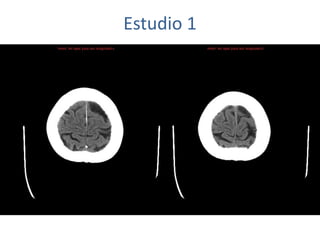 Estudio 1
 