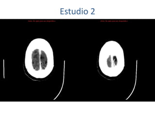 Estudio 2
 