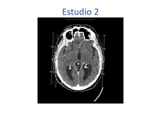 Estudio 2
 