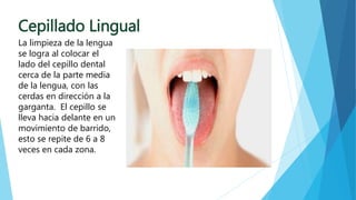 Cepillado Lingual 
La limpieza de la lengua 
se logra al colocar el 
lado del cepillo dental 
cerca de la parte media 
de la lengua, con las 
cerdas en dirección a la 
garganta. El cepillo se 
lleva hacia delante en un 
movimiento de barrido, 
esto se repite de 6 a 8 
veces en cada zona. 
 