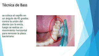 Técnica de Bass 
se coloca el cepillo en 
un ángulo de 45 grados 
contra la unión del 
diente con la encía, 
luego se realiza un 
movimiento horizontal 
para remover la placa 
bacteriana. 
 
