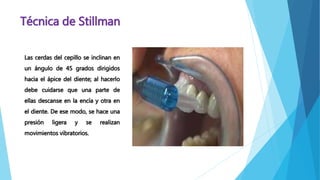 Técnica de Stillman 
Las cerdas del cepillo se inclinan en 
un ángulo de 45 grados dirigidos 
hacia el ápice del diente; al hacerlo 
debe cuidarse que una parte de 
ellas descanse en la encía y otra en 
el diente. De ese modo, se hace una 
presión ligera y se realizan 
movimientos vibratorios. 
 