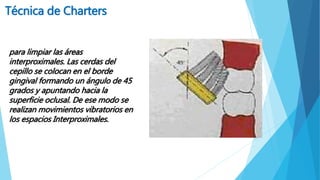Técnica de Charters 
para limpiar las áreas 
interproximales. Las cerdas del 
cepillo se colocan en el borde 
gingival formando un ángulo de 45 
grados y apuntando hacia la 
superficie oclusal. De ese modo se 
realizan movimientos vibratorios en 
los espacios Interproximales. 
 