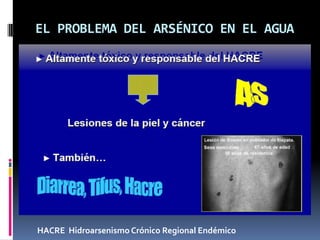 EL PROBLEMA DEL ARSÉNICO EN EL AGUA




HACRE Hidroarsenismo Crónico Regional Endémico
 