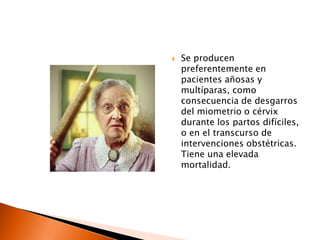 Durante el embarazo son frecuentes las pequeñas embolias de trofoblasto, que por lo general no llegan a producir clínica.