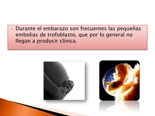 La embolia séptica se produce por acúmulos de bacterias, las más frecuentes estafilococos, que se desplazan desde una tromboflebitis séptica o una endocarditis derecha. 