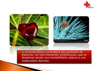 Se ve con frecuencia en drogadictos vía parenteral, y en pacientes con catéteres intravenosos permanentes o sometidos a hemodiálisis. Se debe tratar con antibióticos