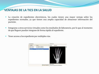 VENTAJAS DE LA TICS EN LA SALUD
 La creación de expedientes electrónicos, los cuales tienen una mayor ventaja sobre los
   expedientes normales, ya que tienen una amplia capacidad de almacenar información del
   paciente.

 Integrarse a otros servicios virtuales como los resultados de laboratorio, por lo que al momento
   de que lleguen puedan integrase de forma rápida al expediente.

 Tener acceso a los expediente por múltiples vías.
 