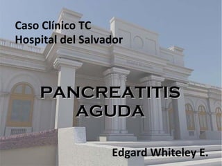 Caso Clínico TC
Hospital del Salvador
PANCREATITISPANCREATITIS
AGUDAAGUDA
Edgard Whiteley E.
 