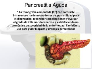 Pancreatitis Aguda

La tomografía computada (TC) con contraste
intravenoso ha demostrado ser de gran utilidad para
el diagnóstico, reconocer complicaciones y evaluar
el grado de inflamación y necrosis, estableciendo un
pronóstico de severidad de la enfermedad. También se
usa para guiar biopsias y drenajes percutáneos
 